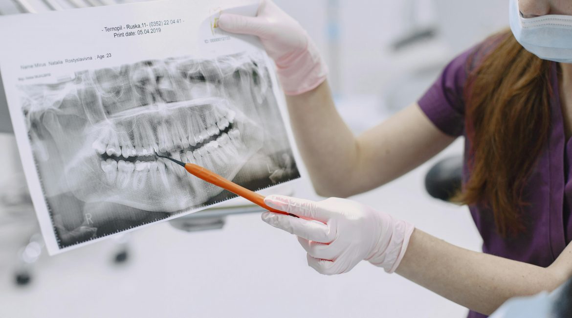 Escáner intraoral 3D en Clínica Doctores Aguado