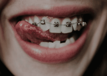 Blog Doctores aguado 1 | Clínica dental Doctores Aguado ¿Para qué sirve un irrigador dental?